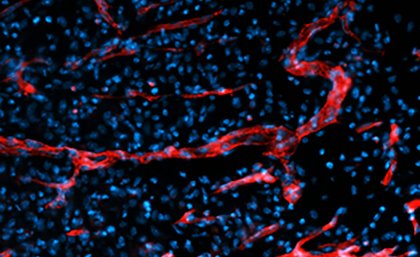 A blood vessel within a wound A blood vessel within a wound